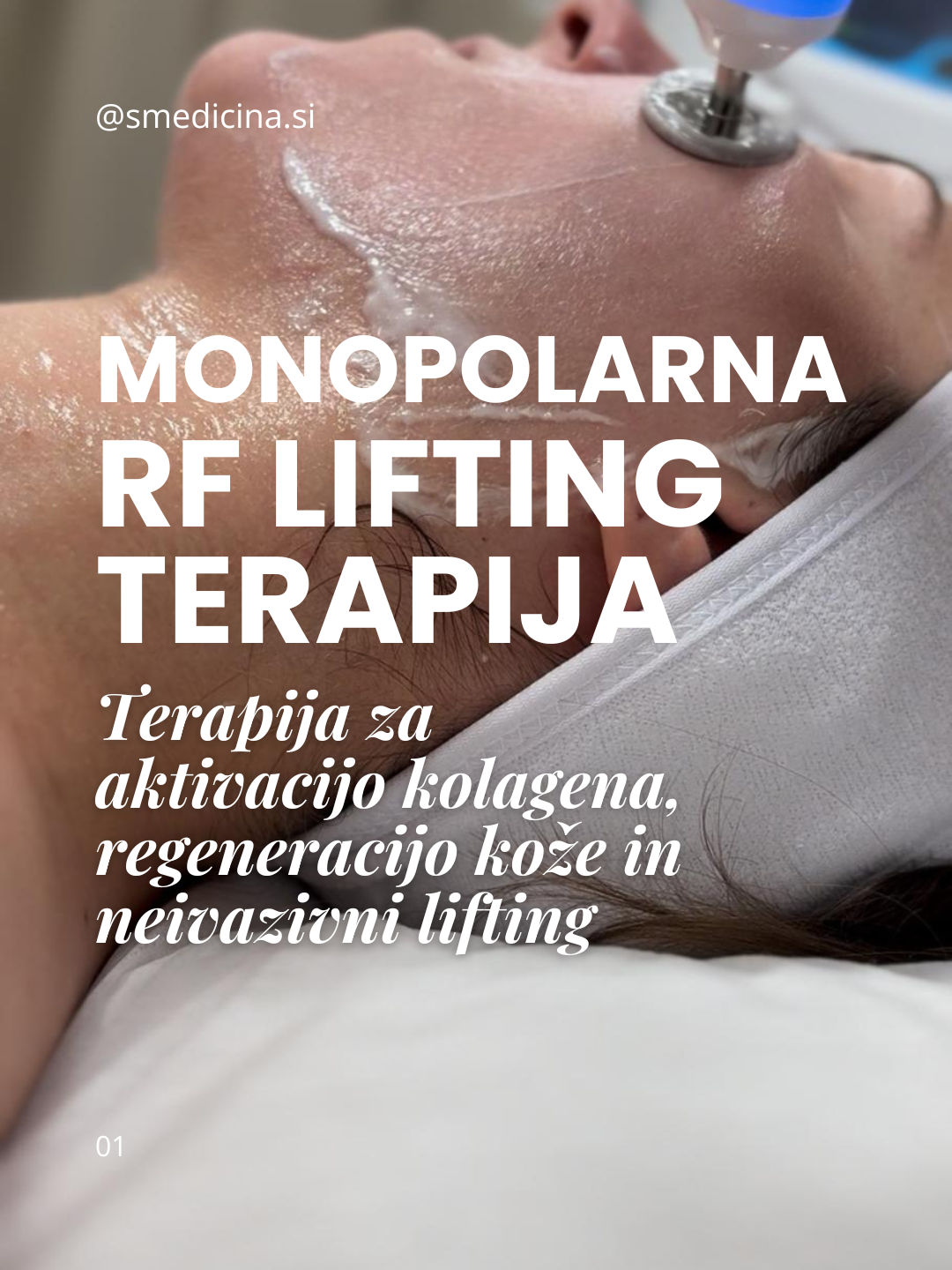 Monopolarna RF lifting terapija